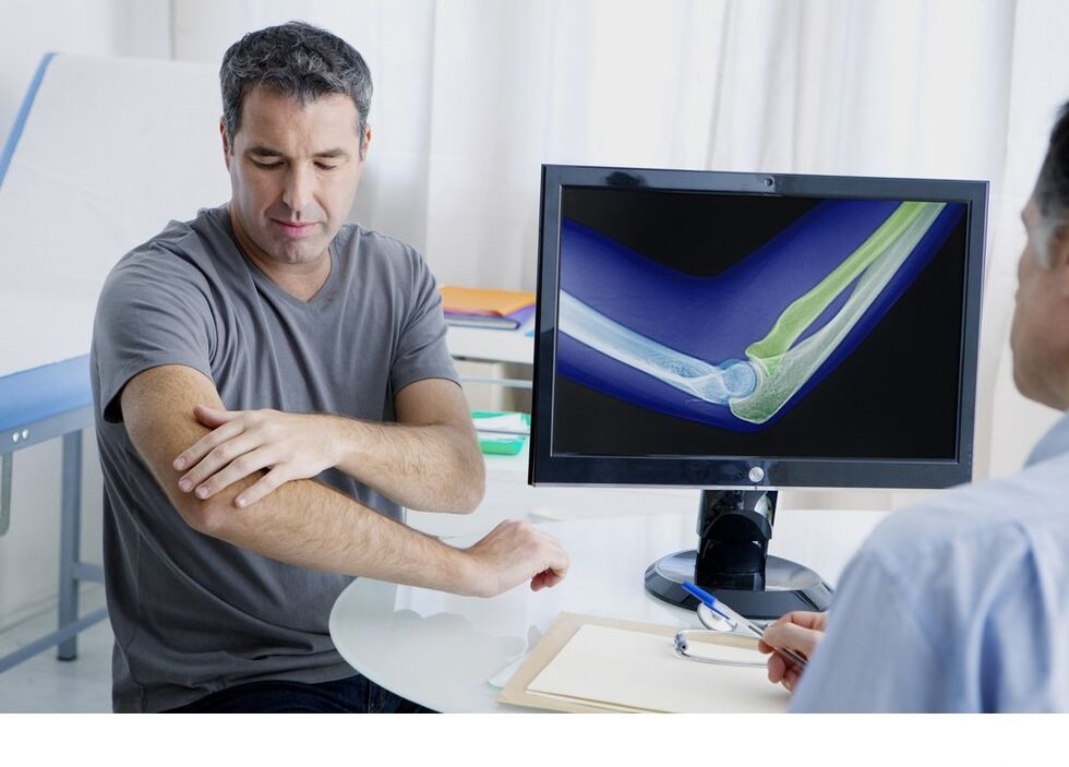 Arthrose des Ellbogengelenks im X -Ray -Bild
