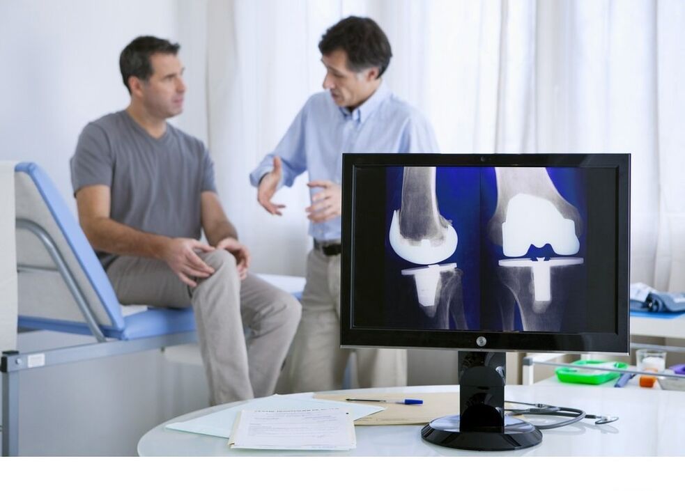 Arthrose des Kniegelenks im X -Ray -Bild